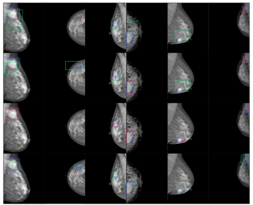 DDSM to INBreast qualitative results