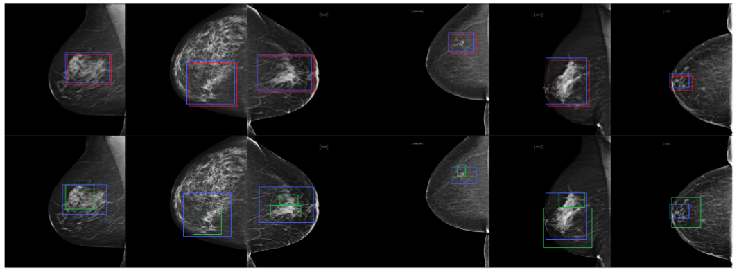DDSM to RSNA qualitative results