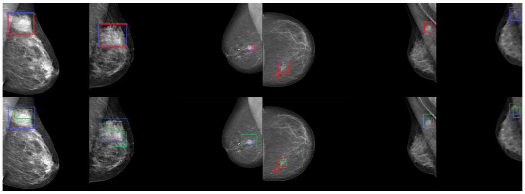 RSNA to INBreast qualitative results
